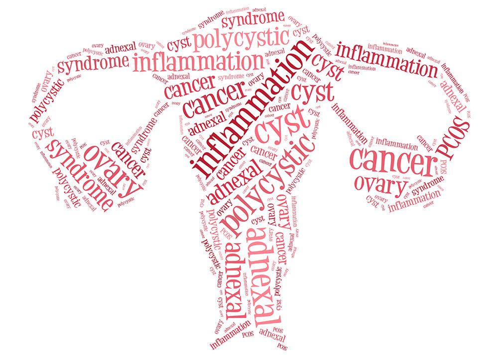 PCOS (Polycystic Ovarian Syndrome)